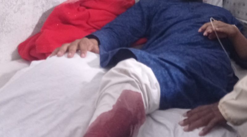 ময়মনসিংহ ৬(ফুলবাড়ীয়া) আসনে ঘোড়ার সমর্থক আশিককে রক্তাক্ত জখম